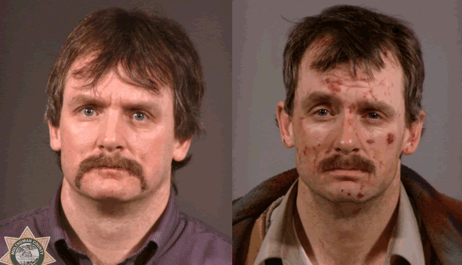 Meth before and after photo 2. The above faces of Meths before and after photos are courtesy of publically made available sheriff department arrest photo files from individuals suffering from addiction to meth.  Here the faces of meths photos clearly show the horrific impact of meth addiction's toll during a short three-month period.  Large meth face soars cover both sides of the face and the forehead in such a short span.
