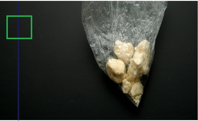 Addicted users who stop freebasing cocaine, or using cocaine in general, will undergo an initial crash, known as withdrawal. Withdrawal can be intense and complex due to cravings and uncomfortable side effects.