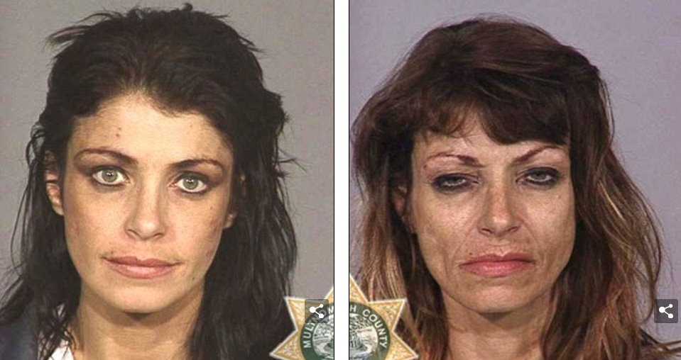Meth before and after photo 3. In the above faces of meths before and after photos, this woman looks to have aged dramatically in about seven years with deep wrinkles, sagging skin, and dark circles under her eyes.  The addict's meth face is completely ravaged as if she aged decades vs. years.
