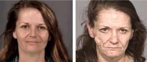 Meth addicts often have poor hygiene habits and may scratch or pick at their skin, leading to sores, scabs, and scars. Over time, this can cause the skin to deteriorate, leading to a rough, leathery texture and a prematurely aged appearance. as shown in the meth addiction pictures before and after.