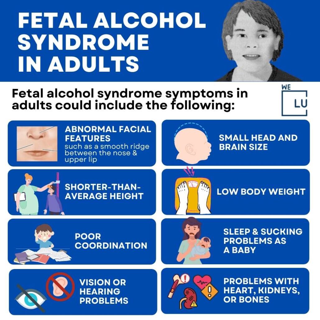 The above chart on “Fetal Alcohol Syndrome in Adults” Shows the physical signs of Fetal Alcohol Syndrome.