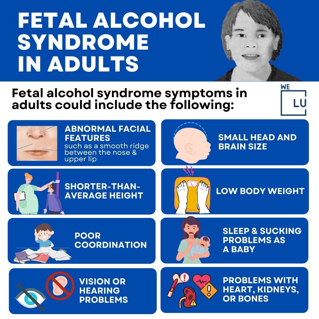 Fetal Alcohol Syndrome In Adults Symptoms, Facial Signs