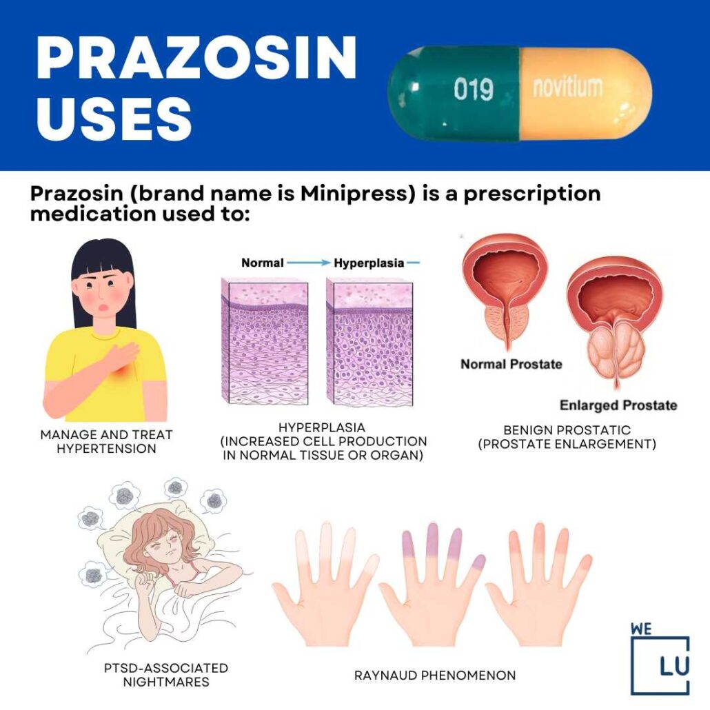 What are the best practices for taking Prazosin to minimize side effects? What are the best practices for taking Prazosin to minimize side effects?