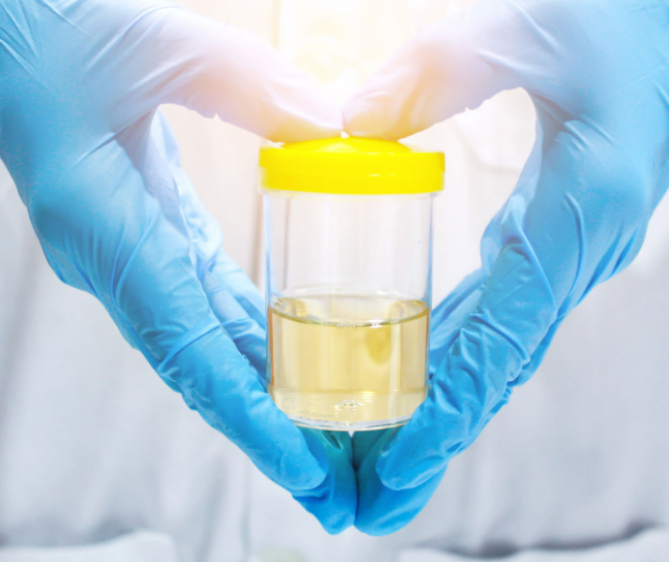 How long does oxycodone stay in urine? Oxycodone use can be traced back three days in the urine. Urine drug testing, while commonly used, is not necessarily an accurate predictor of drug abuse or dependence. Those with questions or concerns about oxycodone use should consult a doctor or an addiction specialist.