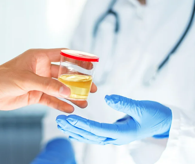 Certain alcohol tests can identify alcohol metabolites present in urine even after the elimination of alcohol. This indicates that alcohol in your urine may persist despite cessation of alcohol consumption.
