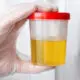 how long does meth stay in urine featured image