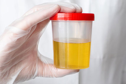 how long does meth stay in urine featured image